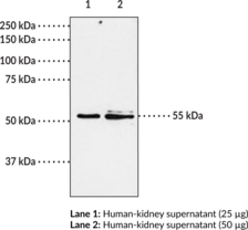 BLT<sub>1</sub> Receptor Polyclonal Antiserum