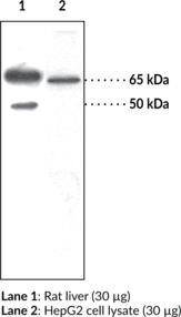 SOAT-<wbr/>1/ACAT-<wbr/>1 Polyclonal Antibody