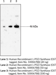 Prostaglandin D Synthase (lipocalin-<wbr/>type; human) Monoclonal Antibody (Clone 10A5)