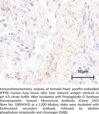 Prostaglandin D Synthase (hemato<wbr/>poietic-<wbr/>type; human) Monoclonal Antibody (Clone 2A5)