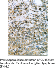 CD45 Monoclonal Antibody (Clone BRA-55)