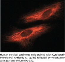 Cytokeratin Monoclonal Antibody (Clone C-<wbr/>11)