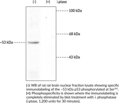 p53 (Phospho-<wbr/>Ser<sup>392</sup>) Polyclonal Antibody