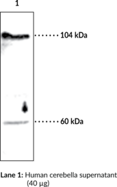 Lyso<wbr/>phospholipase D Polyclonal Antibody