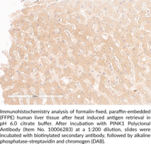 PINK1 Polyclonal Antibody