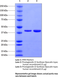 Prostaglandin D Synthase (lipocalin-<wbr/>type; human recombinant)