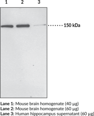 PH Domain Leucine-<wbr/>rich Repeat Protein Phosphatase 1 Polyclonal Antibody