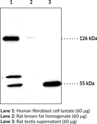 SREBP-<wbr/>2 Polyclonal Antibody