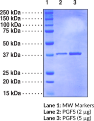 Prostaglandin F Synthase (human, recombinant)