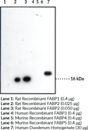 FABP2 Polyclonal Antibody