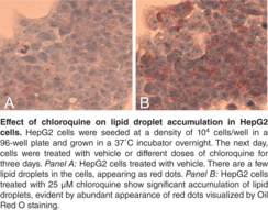 Steatosis Colorimetric Assay Kit