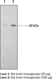 CB<sub>1</sub> Receptor Polyclonal Antibody