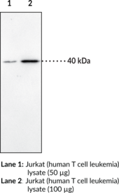 CB<sub>2</sub> Receptor Polyclonal Antibody