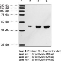 DP<sub>1</sub> Receptor Polyclonal Antibody