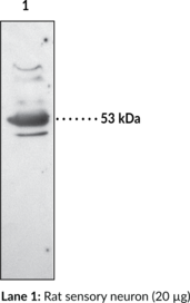 EP<sub>3</sub> Receptor Polyclonal Antibody