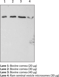 FP Receptor Polyclonal Antibody