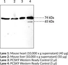 PCSK9 (human) Polyclonal Antibody