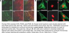 Prostaglandin I Synthase Monoclonal Antibody (Clone 3C8)