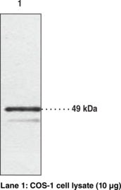 Chemokine-<wbr/>Like Receptor 1 Polyclonal Antibody