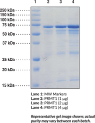 PRMT1 (human recombinant)