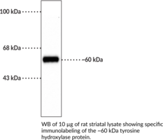 Tyrosine Hydroxylase (rat, denatured) Polyclonal Antibody