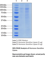 Hormone-Sensitive Lipase (human, recombinant)