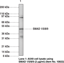 SMAD1/5/8/9 Polyclonal Antibody
