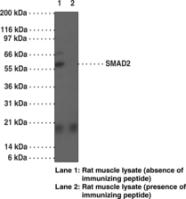 SMAD2 Polyclonal Antibody