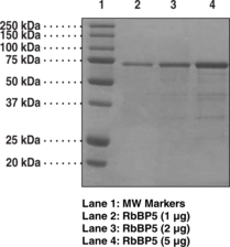 RbBP5 (human, recombinant)