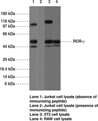 ROR? Polyclonal Antibody