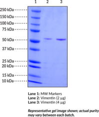 Vimentin (human, recombinant)