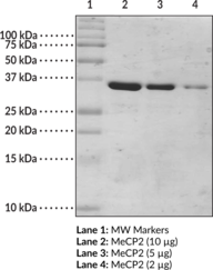 MeCP2 (human recombinant; methyl binding domain aa 77-<wbr/>166)