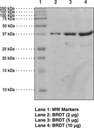 BRDT bromodomain 1 (human, recombinant)