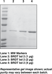 BRDT bromodomain 2 (human recombinant)