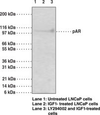 Androgen Receptor (Phospho-<wbr/>Ser<sup>210,213</sup>) Monoclonal Antibody (Clone 156C135.2)