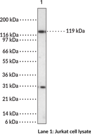 HDAC4 Polyclonal Antibody