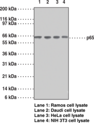 NF-?B (p65) Monoclonal Antibody (Clone 112A1021)