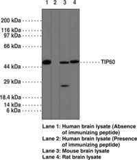 TIP60 Polyclonal Antibody