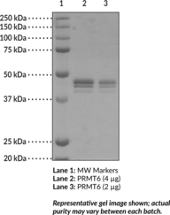 PRMT6 (human recombinant; baculovirus expressed)