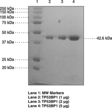 TP53BP1 tudor-<wbr/>like region (human recombinant)