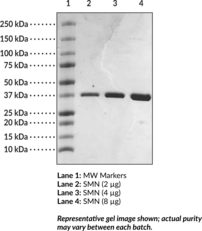 SMN tudor domain (human recombinant)