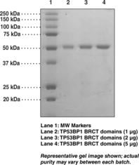 TP53BP1 BRCT domains (human recombinant)