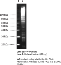 Multi<wbr/>ubiquitin Chain Monoclonal Antibody (Clone FK2)