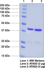 ATAD2 bromodomain (human recombinant)