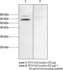 MBOAT1 Polyclonal Antibody