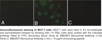 MBOAT5 Polyclonal Antibody