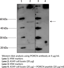 PORCN Polyclonal Antibody