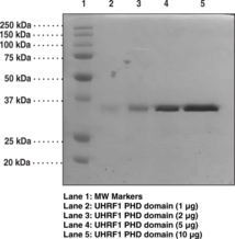 UHRF1 PHD domain (human recombinant)