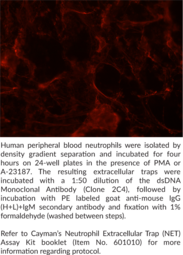 dsDNA Monoclonal Antibody (Clone 2C4)