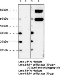 HHATL Polyclonal Antibody